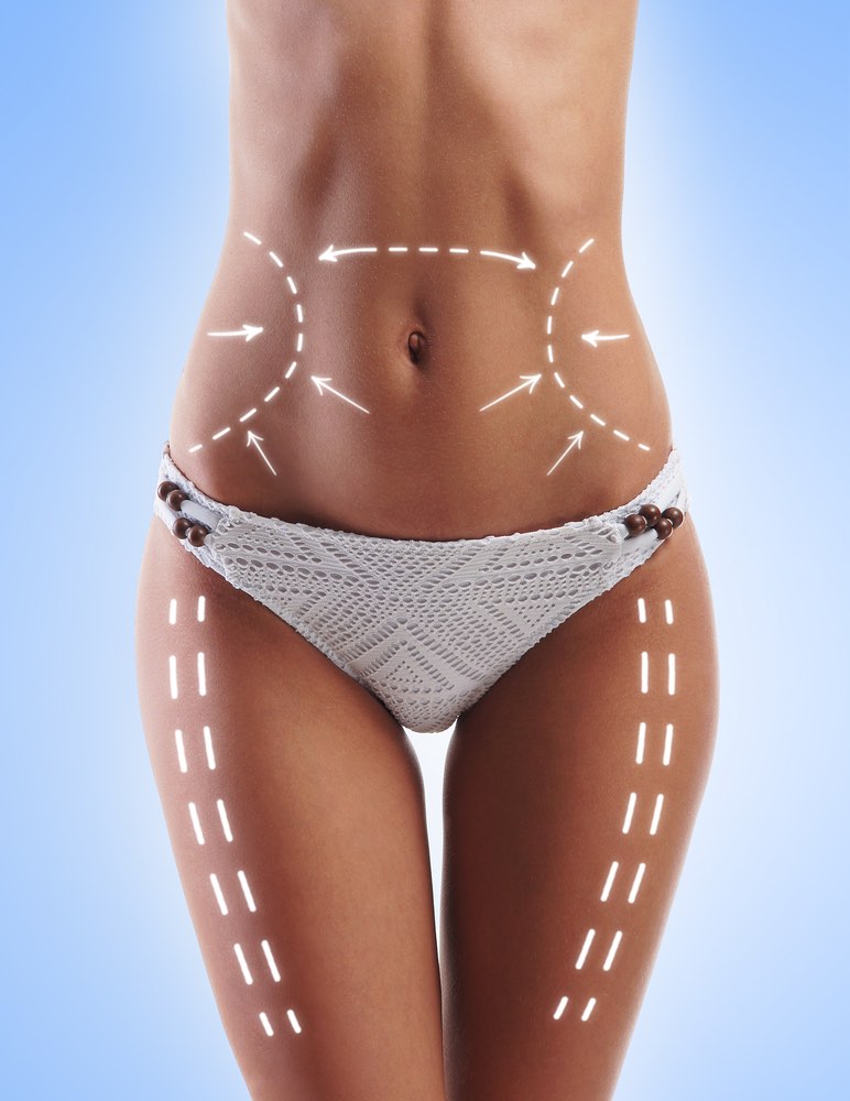 Aqualyx Fettweg-Spritze München