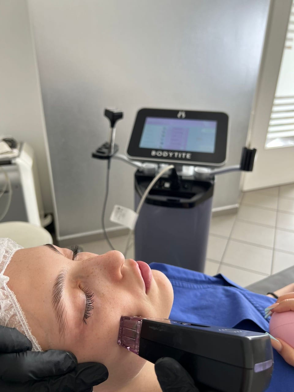 Morpheus8 Deep Needling München